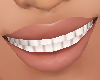 Perfect Smile
