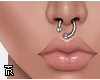 ❥ Shifted Septum. S