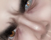 Ⓐ - Heterochromia MH