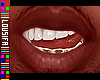 †. M Teeth 13