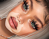 Vitiligo MH