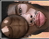 Vitiligo Man Skin