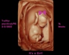 Custom Ultrasound Pic