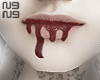 ★bloody