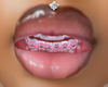 LGHT PNK braces