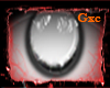 /GxC/ Cataract