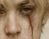 ★ face scar
