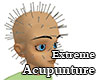 Extreme Acupuncture