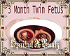 3 Month Twins In Tummy