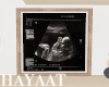 Framed Ultrasound