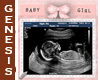 babygirl ultrasound