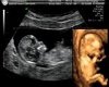 3d ultra sound picture
