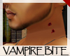 Vampire Bite