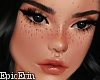 Realistic Freckle Skin 3