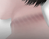rope mark neck