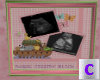 Baby Girl Ultrasound 