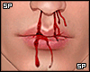 s. Asteri blood  nose