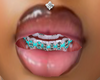 TURQ braces