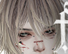 wound