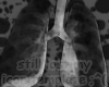 skele lungs :3