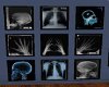9 frame X-Ray pictures
