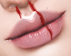 A| Blood lips