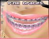 $ Pink braces PROPORTION
