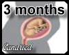 Prego tummy (3 months)
