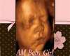 AM Baby Girl Sonagram