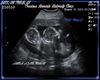 *J79*As.Thomas Ultrasoud