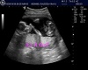 its a girls