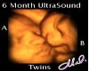 6 Month Twins U.S.