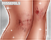 Scraped Knees | LLT
