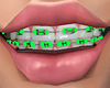 Neon Green braces .