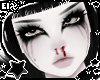 . misery